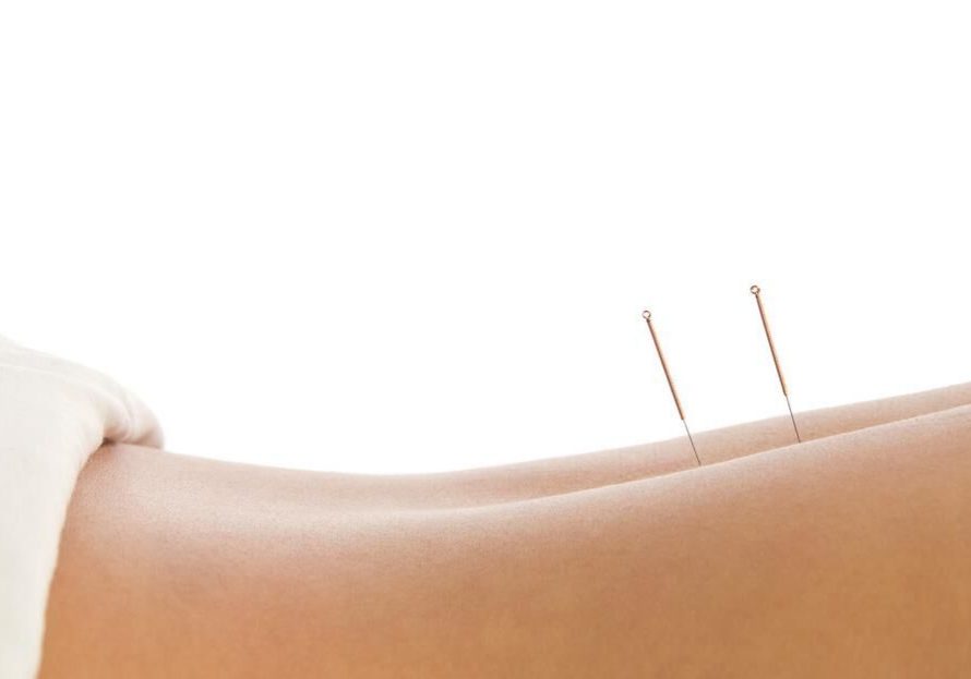 Akupunktur ryg